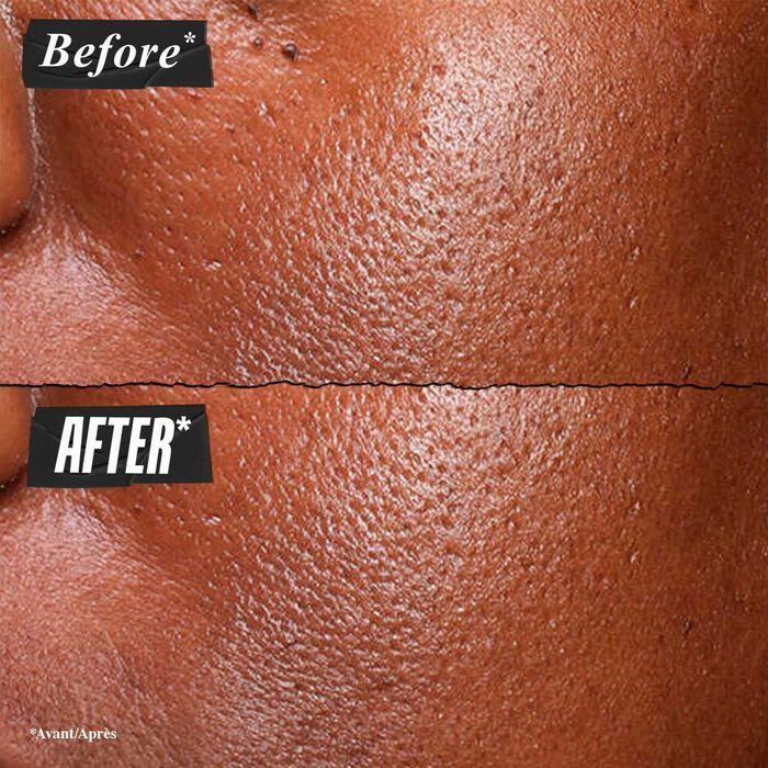 Kiehl's Since 1851 Sérum Ultra Pur - Serum Facial Con Niacinamida