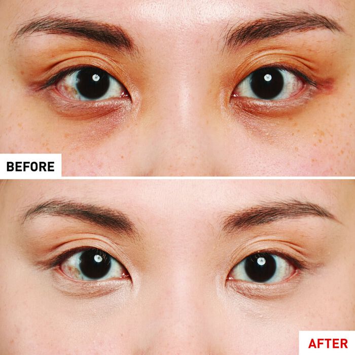 Erborian Super BB Concealer - Antiojeras Alta Cobertura Con Ginseng