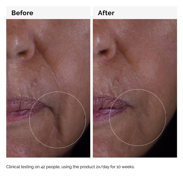 The Ordinary Solution GF 15% - Sérum Antiedad