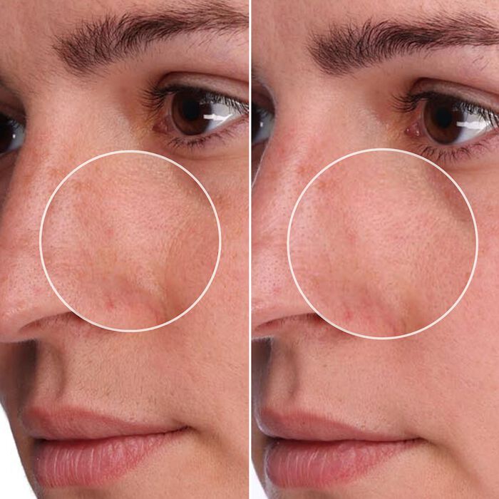 Benefit Cosmetics The POREfessional Shrink Wrap - Tratamiento Nocturno Para Poros Con AHA+PHA