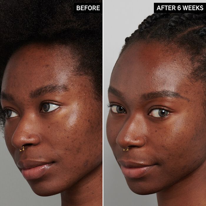 The Inkey List Tratamiento De Noche Para Hiperpigmentación Con ácido Tranexámico