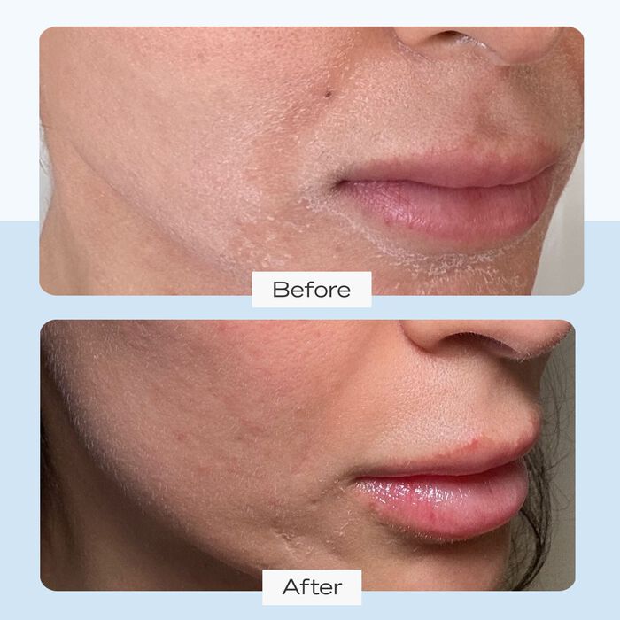 First Aid Beauty Ultra Repair Cream Intense Hydration - Crema Ultra Reparación