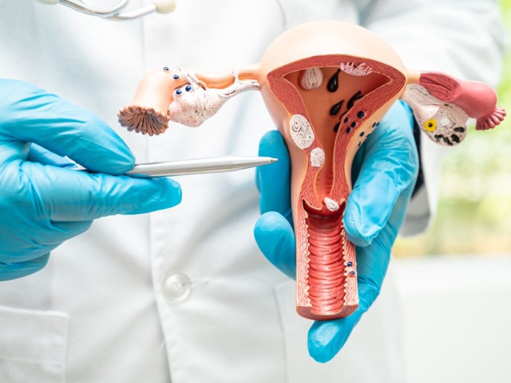 Mimub La Relevancia de la Detección Temprana del Cáncer Ginecológico Según el Dr. Juan Céspedes